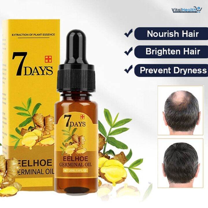EELHOE King of Ginger 7 Days Germinal Oil For Hair Growth thumbnail 2