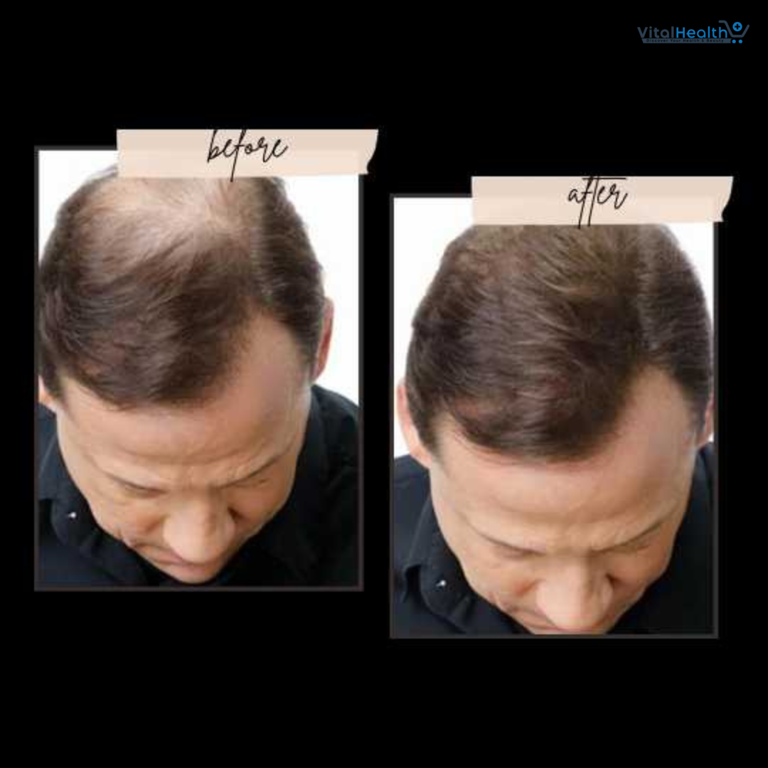 Toppik Hair Fiber Holding Spray, Instant Fuller Looking Hair